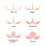 How Active Adults Can Prevent Skin Rashes from Adult Diapers?