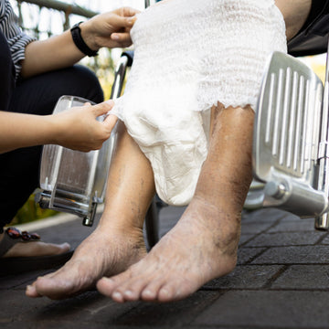 Adult Nappy Rash