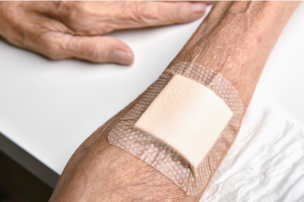 What is MARSI and How It Affects a Patient's Skin Health ?