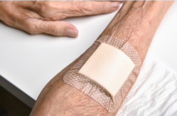 What is MARSI and How It Affects a Patient's Skin Health ?