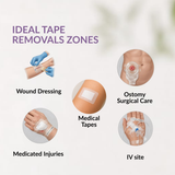 Soreze Cleanse Spray | Medical Adhesive Remover Spray | Dermatologically Tested | 30ml and 70ml image 2